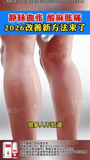 静脉曲张不容忽视，小腿静脉曲张怎么办！点击了解详情!