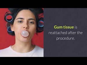 Loose tooth remedy | Loose Teeth in Adults: What You Should Know