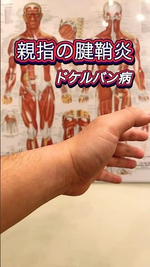 【セルフ】腱鞘炎のテーピング