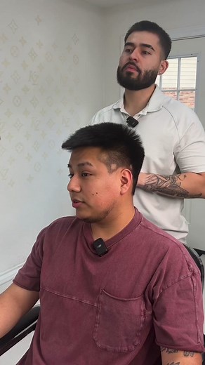 Alopecia Client Hair Transformation | Best Barber Los Angeles