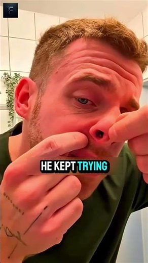 an object is stuck in this man’s nose