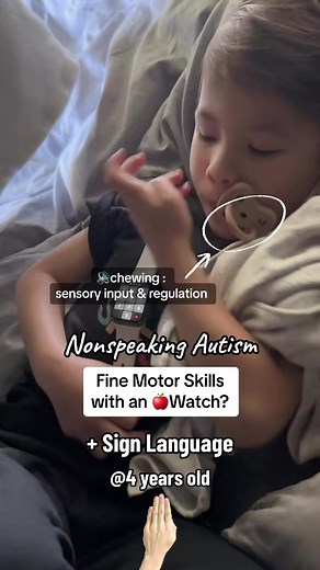 17K views · 559 reactions | In traditional occupational therapy,...