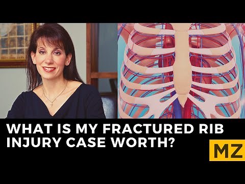 What Is My Fractured Rib Injury Case Worth? Get the Settlement Value of Your Claim.