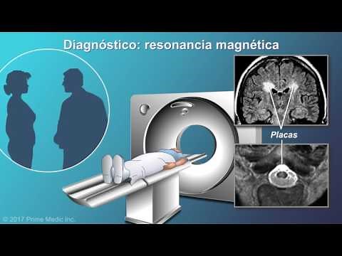 Diagnosis of multiple sclerosis