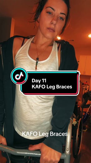 Walking in my leg braces, my phone got stuck uploading a video on my other account. So I’m now finally able to post again. #kafolegbraces #legbraces #incompleteparaplegic #spinalcordinjuryrecovery