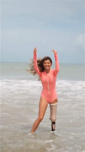 Above Knee Amputee Girl Walking Confidently with Prosthetic Leg Advanced Artificial Limbs Inspiratio