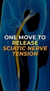 8.4K views · 152 reactions | Struggling with sciatic pain? Here’s why...