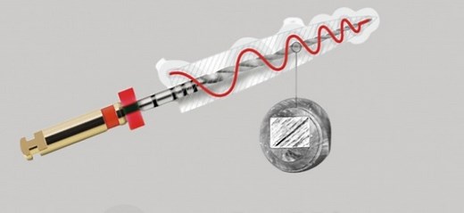 Todo lo que debes saber sobre las limas de endodoncia: (II) Limas rotatorias