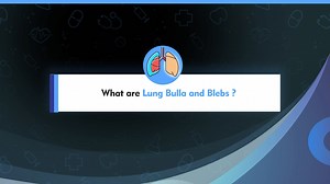 Get to know what lung bulla and blebs are and why is it important to keep a check on them as Dr. Kamran Ali, Lung Transplant & Thoracic Surgeon, Marengo Asia Hospitals, Faridabad, tells us about this topic in detail. Don't forget to share the video to raise awareness and save people from suffering from complex lung bulla and blebs. #MarengoAsia #PatientFirst | Marengo Asia Hospitals