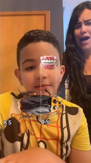 Filter: Eating a cockroach 🪳 Don't do this! #shorts #funny