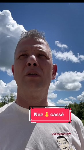 Comment réagir face à un nez cassé ?