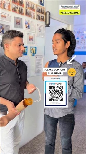 Artificial Hand | Robotic Hand | Nakli Haath | Above Elbow Prosthesis #ossur #ampute #artificialhand