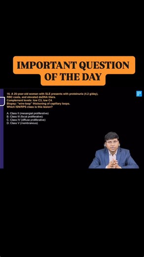 Rajesh Gubba on Instagram: "🩺 **NEPHROLOGY QUIZ — LUPUS NEPHRITIS (ISN/RPS CLASSIFICATION)** A **25-year-old woman with SLE** presents with: • **Nephrotic-range proteinuria** (4.2 g/day) • **RBC casts** • **Elevated anti-dsDNA titers** • **Low complements (C3 & C4)** 🧪 **Renal biopsy:** • **“Wire-loop” thickening** of glomerular capillary loops 📌 **Question:** Which **ISN/RPS class** does this lesion represent? A. Class II – Mesangial proliferative B. Class III – Focal proliferative C. **Clas