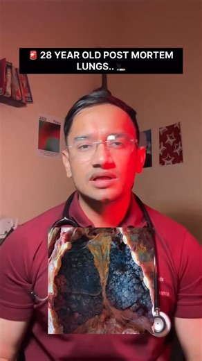 Dr Satyam Badapanda | DrMedMethods on Instagram: "Quit smoking 🚬 🚭 . . . . . . [cigarettes effects , effects of smoking , lungs damage from cigarettes] . . . . #quitsmoking #smokingkills #effectsofsmoking"