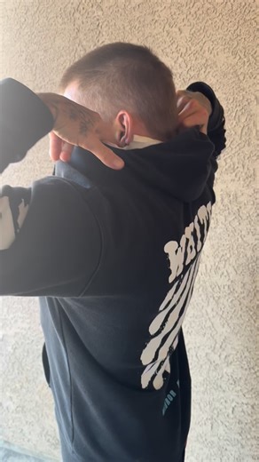 Arrowhood AZ on Instagram: "Thanks to @therealkillabeataz for coming thru and filming this so I can give everyone an update! Today is exactly 2 weeks since I was shot. This is the first look at my head and neck without the tube in my ear or staples around my neck. #stillhere"