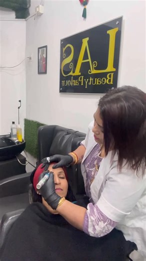 LAS BEAUTY PARLOUR on Instagram: "Before and after Micro needling for Vani 🥰#beautysalon#skincare#makeupartist#microneedle#hairstylist"