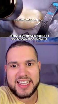Substituição da restauração de Amálgama