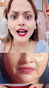 11K views · 136 reactions | Pigmentation 9599043291 Add- CSC Market, Sec-18B, Dwarka, NewDelhi - 110078#facetreatment #faceglow #facebrightening #skincare #viral #nishalambha #instagood #pigmentationtreatment | Nisha Lambha - Sparsh Beauty Care & Hair Treatment LLP | Facebook