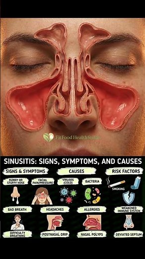Sinusitis Explained 🤧|Signs, Symptoms, Causes & Risk Factors You Must Know!#healthylifestyle #shorts