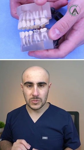 Overbite and Braces #Shorts