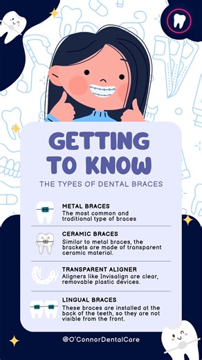 36 shares · 26 comments | Curious about metal braces? They’re one of the most effective and reliable ways to align your teeth. Schedule your assessment and let’s plan your smile transformation! ✨ DISCLAIMER: No copyright infringement intended. We do not own the music used. All rights belong to their respective and rightful owners. This audio is used solely for background music and entertainment purposes only. #YourSmileOurPriority | O'Connor Dental Care | Facebook