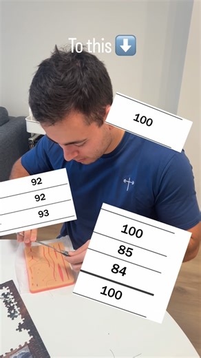 Juan Brussow | Med Student on Instagram: "‼️ How I went from 60s + low 70s → high 80s + 100s in med school ⬇️ 1️⃣ LESS FLASHCARDS, MORE THINKING Anki is great — but memorizing disconnected facts wasn’t translating into exam performance. I shifted toward writing concepts in my own words so I could actually explain why things work, not just recognize answers. 2️⃣ BUILDING SYSTEMS, NOT ISOLATED FACTS Instead of studying topics separately, I started grouping related concepts together and understandi