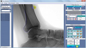 双平面荧光配准系统-Fluo_motion足踝三维步态运动分析