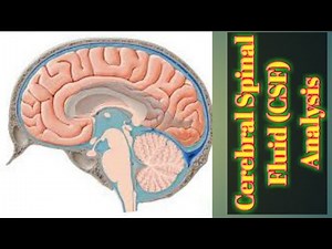 Cerebral Spinal Fluid (CSF) Analysis or Rotine examination (RE): overview