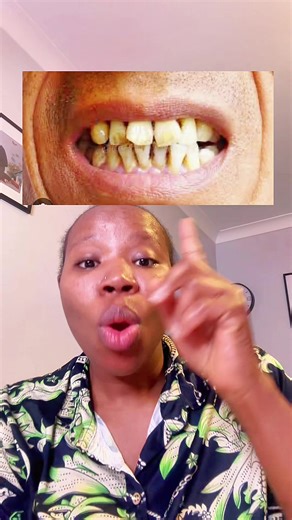 TikTok Teeth Whitening Finds & Care