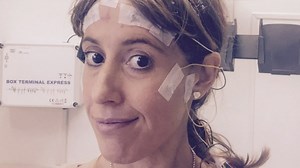 What’s it like to be awake during brain surgery?