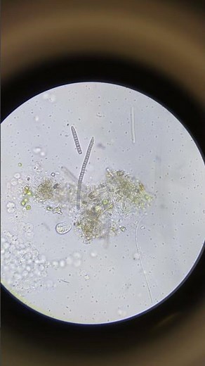 Chilodonella at 400x Koi Scrape Microscope