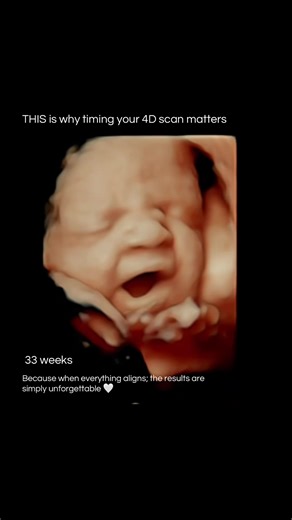 When to Schedule Your 4D Ultrasound Scan