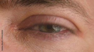 Man crying, red inflamed eye with tears close-up. Male with vision problems, nearsightedness, eyelids inflammation and conjunctivitis eye pupil and iris, blood vessels, anatomical structure of eyeball