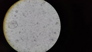 Alive Sperms Dog On Light Microscope Stock Footage Video (100% Royalty-free) 1014149363 | Shutterstock