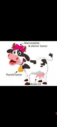 Cowden's Syndrome. Clinical feature and Treatment. Awerenes of all.