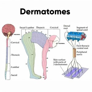 Dermatomes of the Body . www.drmuhammedziya.com . 👉Follow NEW page Health 4 all for more medicine and nutrition posts👈 . ❤️ LIKE 💬 COMMENT 👥 SHARE 💾 SAVE . For non-profit educational purposes only . #drmuhammedziya #suture #pain #skin #skincare #technique #technology #allfollowersfriends #allfollowers #viral #reel #viewers #reelsfacebook #reel #シ #reelsvideoシ #discover #explore #science #sciencefacts #muscle #anatomy #Health4all #Health #anatomy #nutrition #Medicine #MedicalStudent | Dr. Mu