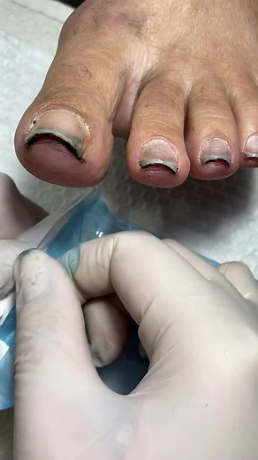 Transformação de Unhas: Dicas e Produtos Usados