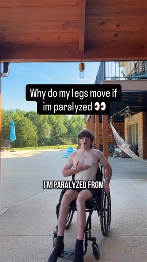 Kaden Sullivan on Instagram: "People are saying I’m a fake paraplegic…here’s a explanation on why and how a paraplegic has muscle spasms that imitate real time leg mobility 👀 #paralyzed #spinalcordinjury #journey #life #fyp"