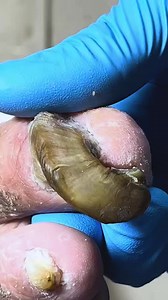 The secret trapped under this nail is unbelievable BRV4 Beautiful moments of care and relaxation through a gentle pedicure experience. Simple, clean, and satisfying. 🌿✨ Disclaimer: This video is for educational and relaxation purposes only. All content belongs to the respective owners, no copyright infringement is intended. | Marcia Villa
