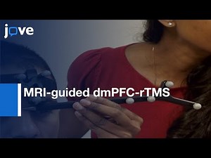 MRI-guided dmPFC-rTMS to treat Treatment-resistant Major Depression | Protocol Preview