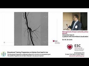 M. De Carlo Interactive Case 2: a patient with intermittent claudication