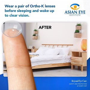 31 reactions · 63 comments | See clearly without the need to undergo eye surgery! Ortho-K lenses are worn right before going to bed and gently reshape your corneas while you sleep. After removing the lenses when you wake up, you can enjoy clear vision that lasts for up to 24 hours! Learn more about Ortho-K by consulting one of our expert doctors here at Asian Eye Institute. Beyond Eye Care: Safety and Protection at Every Step #AskAsianEye #AsianEye2020 | Asian Eye Institute | Facebook