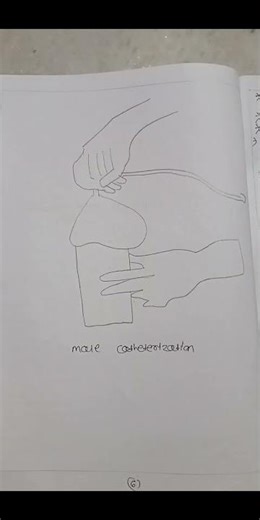 Catheterization procedure step by step 🚑 | Nursing skill made easy 💉 #nursingstudent #ytshorts