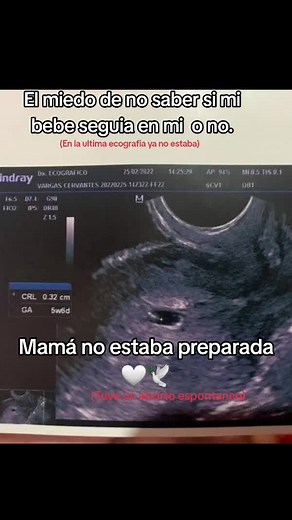 Triste realidad del aborto espontáneo: Duelo y pérdida