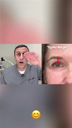 Your Eyelid Margin: What It Is & Where It Should Be #shorts