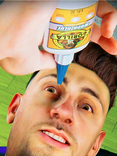 This man accidentally sprayed super glue into his nose instead of nasal spray… what happened next shocked the doctors. He could barely breathe before rushing to the hospital for emergency surgery. #Facts #Story #Medical #Shocking #Hospital #Viral #TrueStory