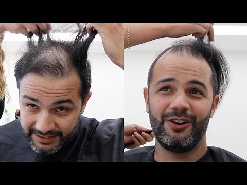 Shaving Off My Comb Over - Head Shave TRANSFORMATION *WOW*