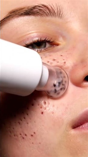 Extreme Macro Cleaning: Vacuum Cuts a Perfect Track Through Clogged Pores”