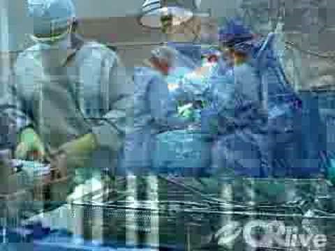 Delta XTEND(TM) Reverse Shoulder System