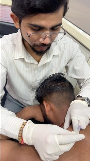Dry Needling Therapy for Trapezius Muscle Knots | Trigger Point Release